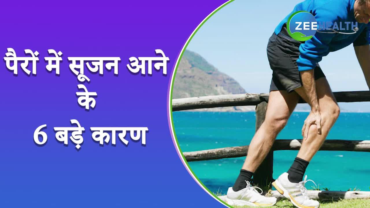 पैरों में सूजन के पीछे हो सकते हैं ये 6 कारण, देखें वीडियो