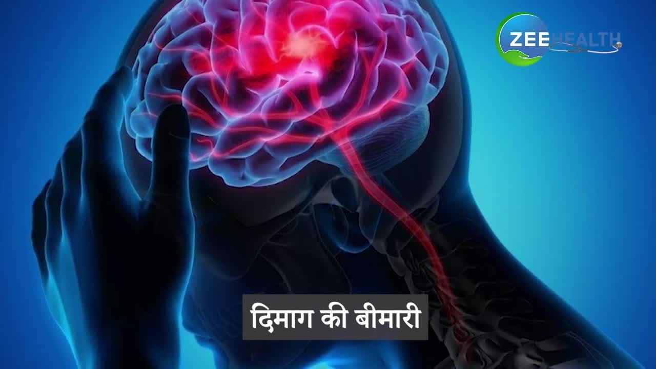 टेंशन लेने से आपको शिकार बना लेती हैं ये बीमारियां, जरूर देख लें वीडियो