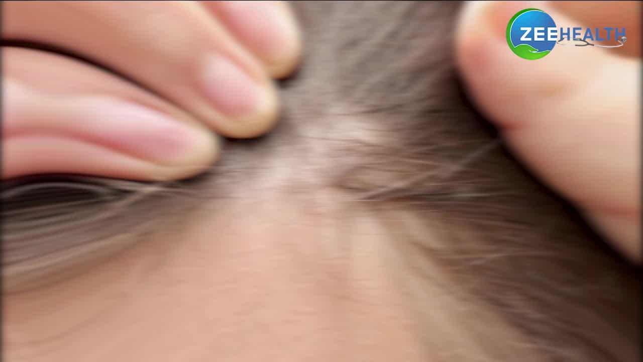 Stop Hair Loss: बालों का झड़ना रोकने के लिए रोजाना करें ये 1 काम, जरूर मिलेगा फायदा