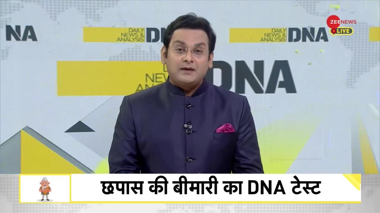 DNA: खिलाड़ी नहीं... नेताओं को चाहिए ट्रॉफी!