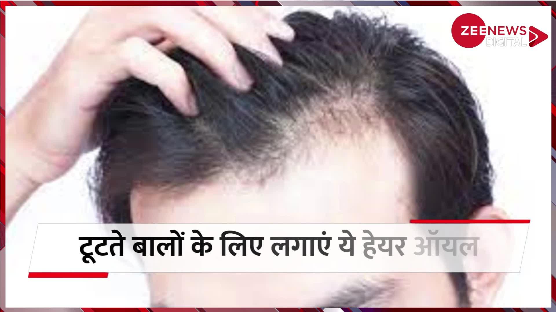 कम उम्र में हो गई है गंजेपन की टेंशन, इन 4 तेलों की मदद से रुकेगा Hair Fall